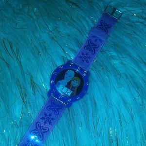 Frozen bracelets/watches